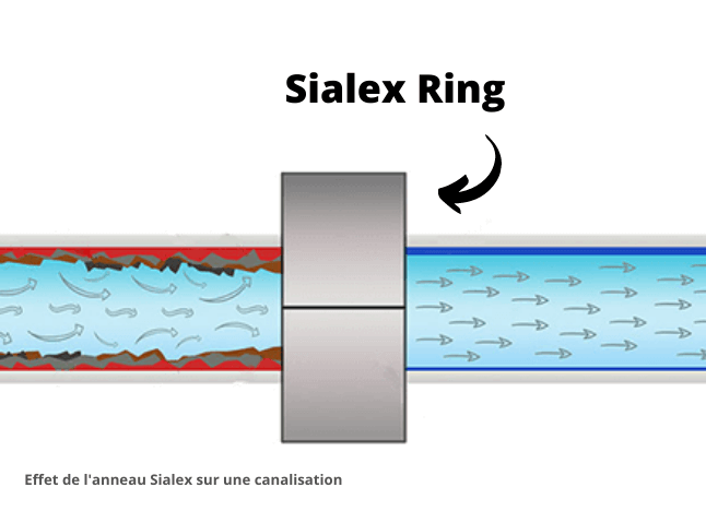 schema-anneau-sialex